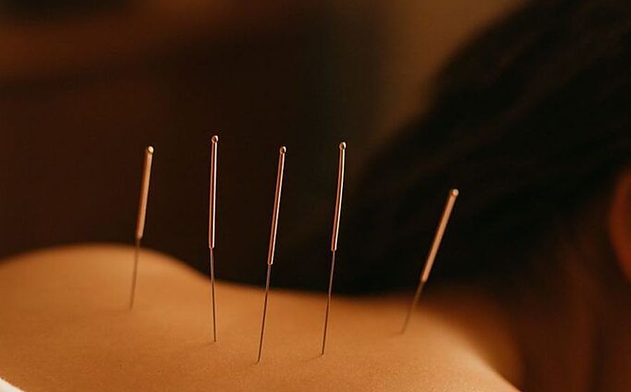 Acupuncture at Aranya